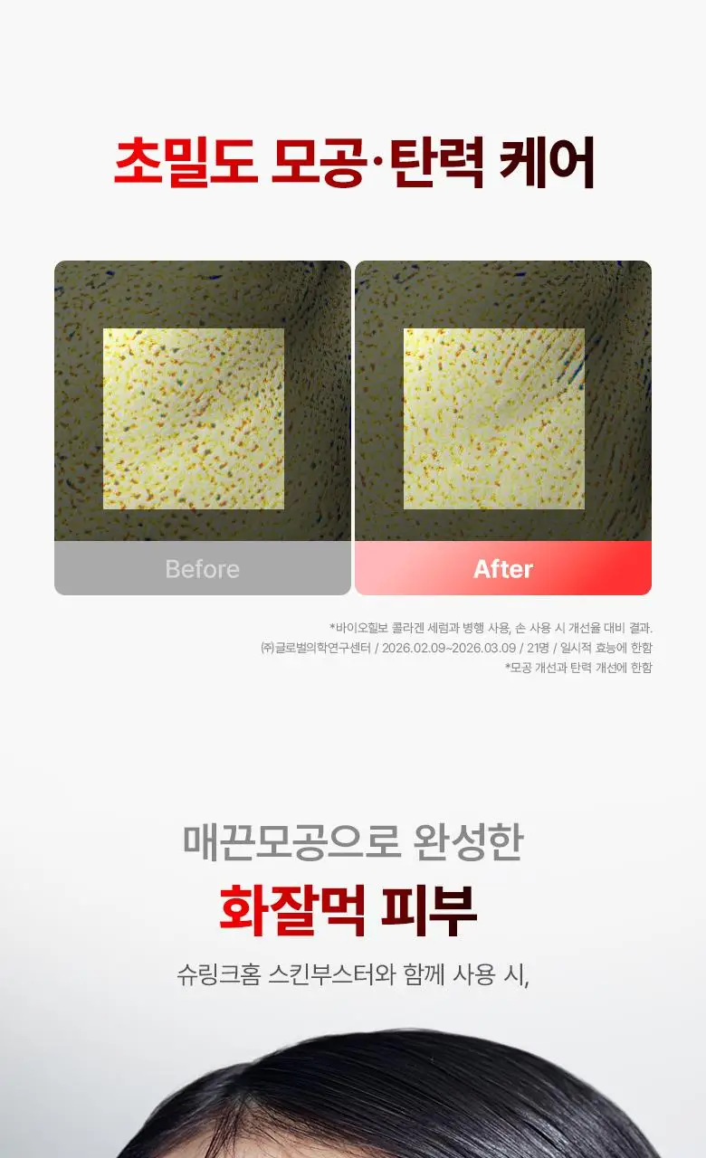 [슈링크홈콜라보|디바이스] 바이오힐보 프로바이오덤 콜라겐 세럼 30ml 슈링크홈기획(+콜라겐겔마스크) 상세페이지 31